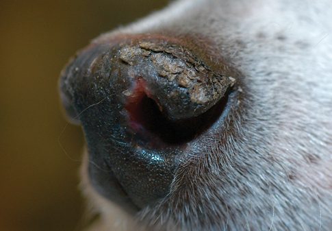 Zinc-Responsive Dermatosis on Nose 