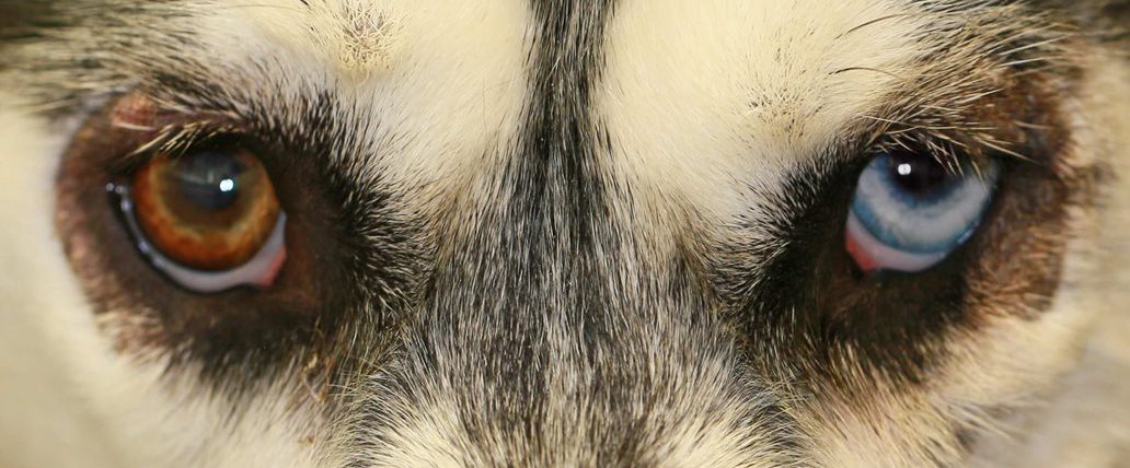 Dark Circles around Husky eyes Caused by Zinc-Responsive Dermatosis 